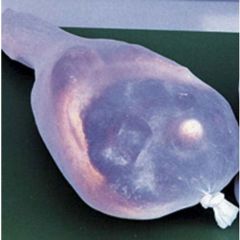 Prosciuttex Calza Elastica cm.160 bianca